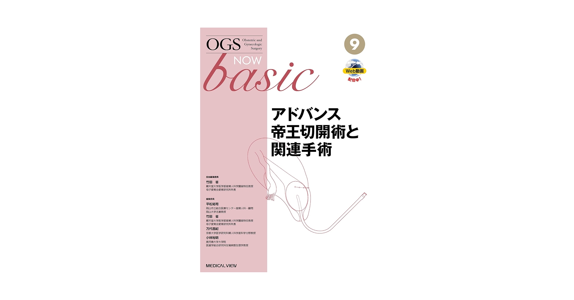 アドバンス帝王切開術と関連手術 (OGS NOW basic 9) | 竹田 省